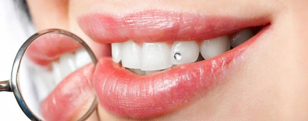 Skyce бриллиант для зуба
